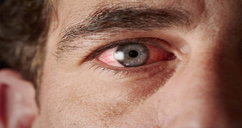 تشخیص اعتیاد از روی مردمک چشم