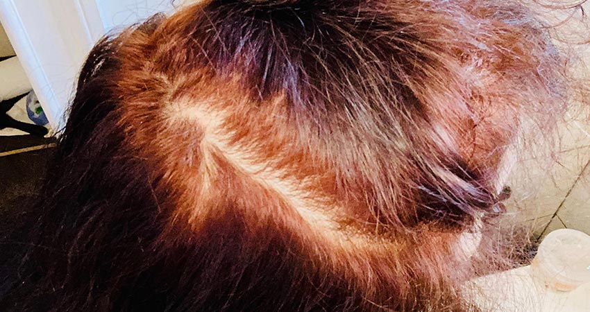 علت روشن شدن رنگ در ریشه مو نسبت به ساقه مو چیست؟