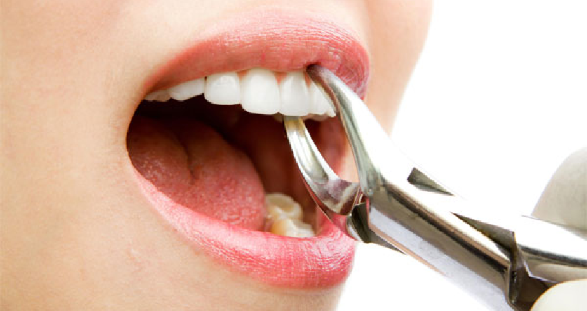 درد استخوان فک بعد از کشیدن دندان؛ چرا؟