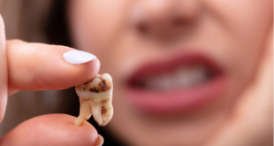 علت زود درآمدن دندان عقل