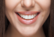 کامپوزیت کاریزما بهتره یا سارمکو