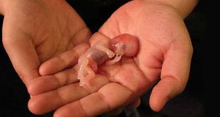 بافت جنین سقط شده چه شکلی است؟