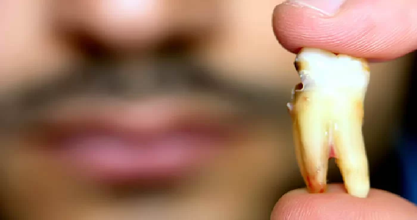 عوارض وجود دندان عقل