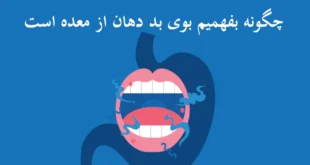 چگونه بفهمیم بوی بد دهان از معده است