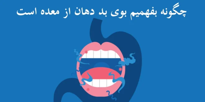 چگونه بفهمیم بوی بد دهان از معده است