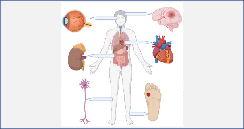 آسیب های بالا بودن قند خون